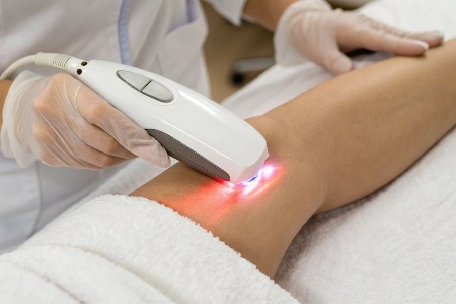 779-smooth-skin-revolution-home-photoepilation Топ-3 профессиональных фотоэпилятора для домашнего использования
